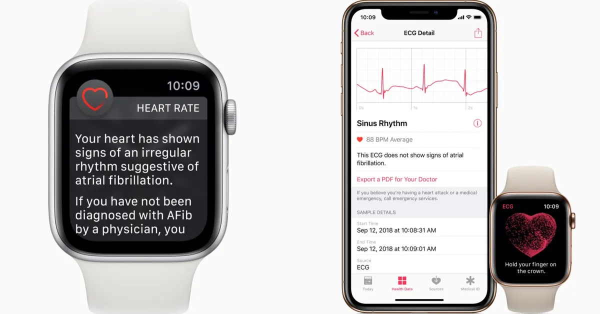 how-often-does-apple-watch-check-for-afib