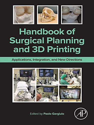 3D Printing in Surgical Planning: Comprehensive Guide and Applications