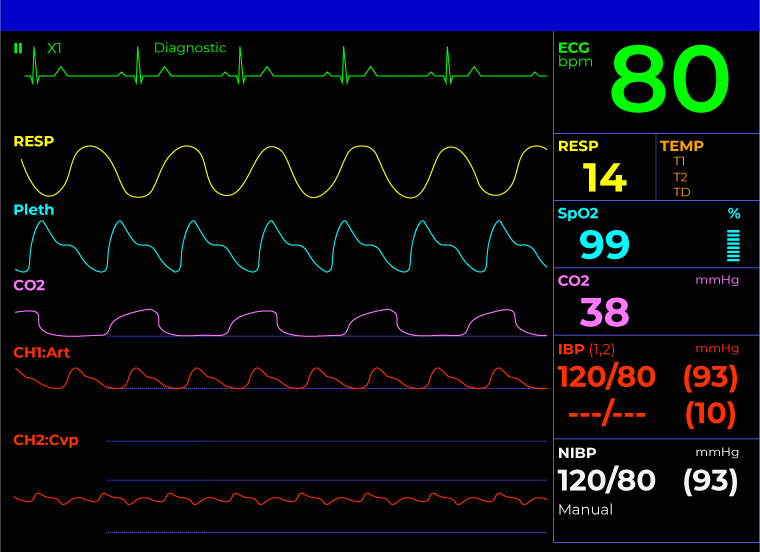 hospital heart rate monitor