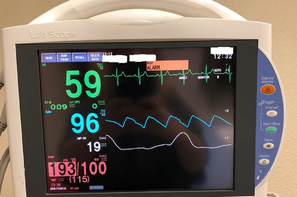 what-is-rr-on-hospital-monitor