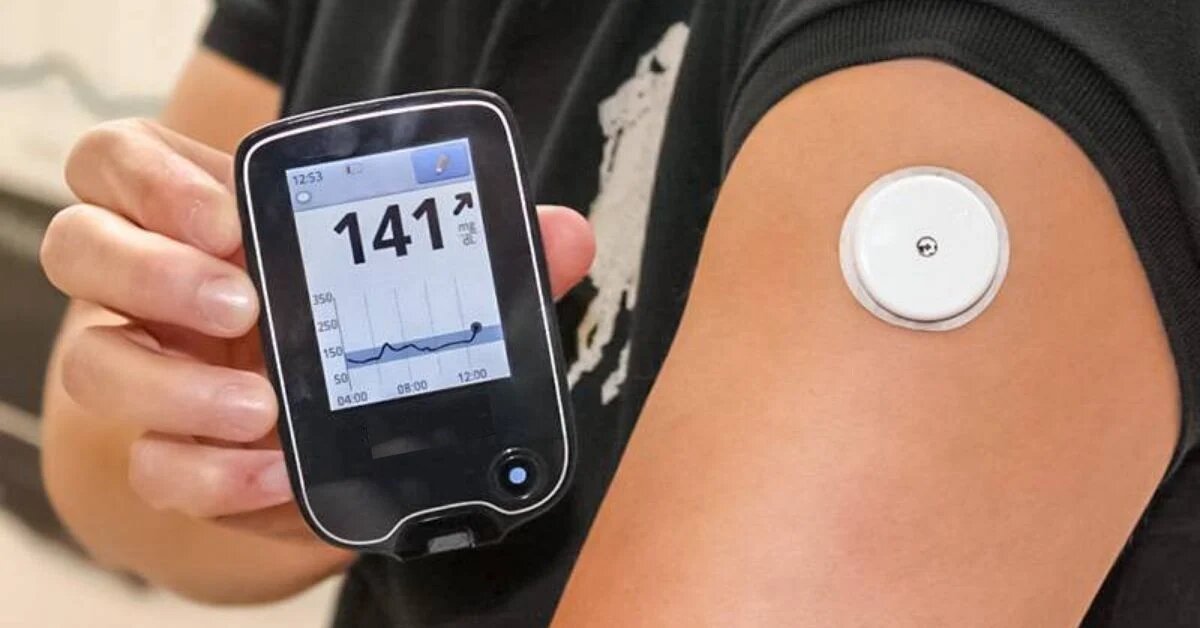 10 Amazing Continuous Glucose Monitor for 2023