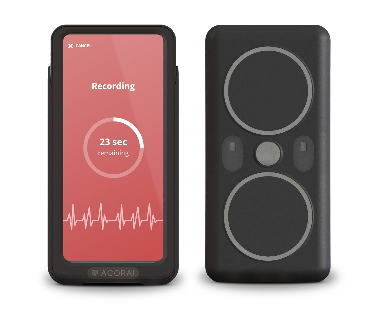 acorais-breakthrough-heart-monitoring-device-gains-attention-with-oversubscribed-seed-round
