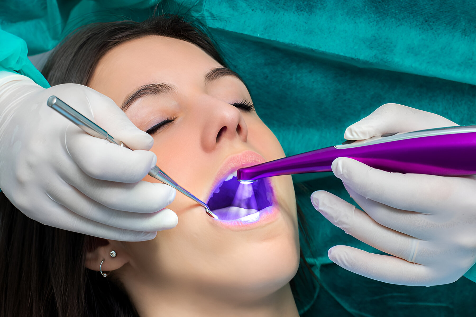 Dental Technology: Understanding The Application Of Blue Light In Dentistry