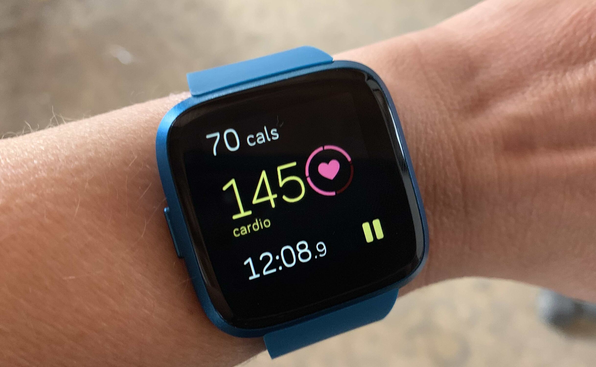 Versa Lite Refresh: A Step-by-Step Guide To Restarting Your Fitbit Versa Lite